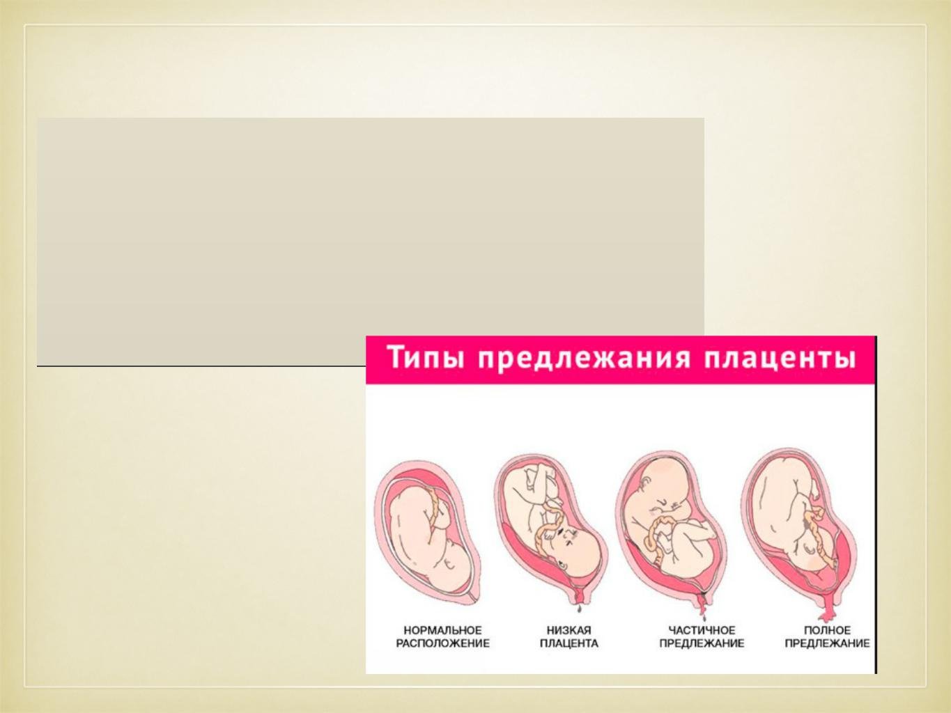 Плацента внутренний зев