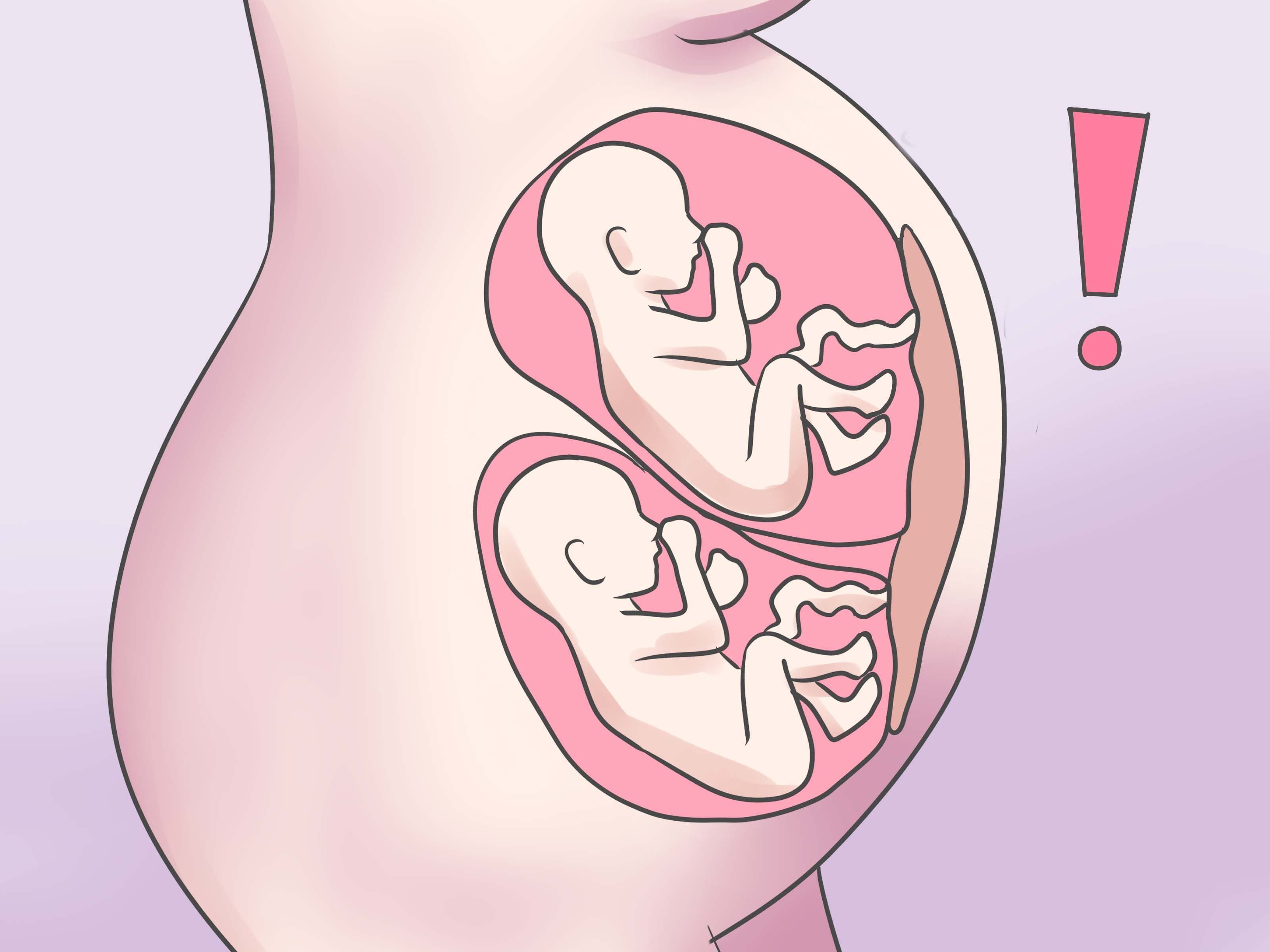 Матка в 11 недель. Расположение плода по неделям. Многоплодная беременность. Расположение ребенка в животе. Многоводня беременность.